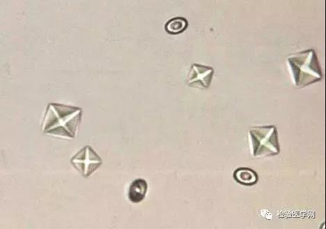 草酸钙结晶砂晶图片